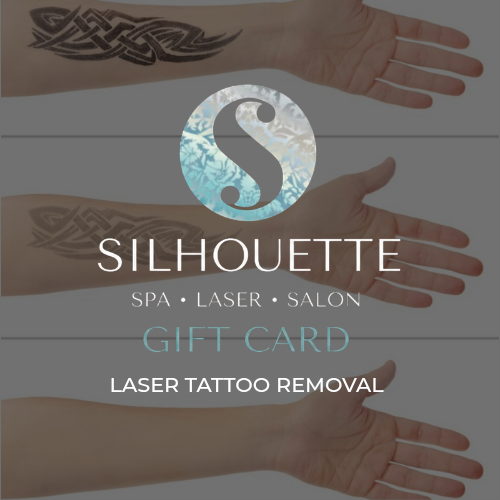 Gift Card Laser Tattoo Removal